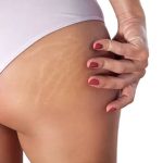 Cómo mantener la salud de la piel en una mujer embarazada